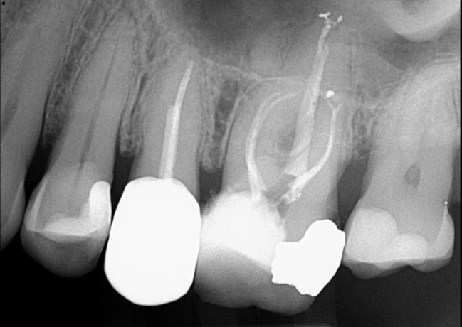 X-ray 1