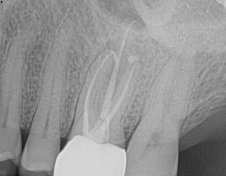 X-ray 2