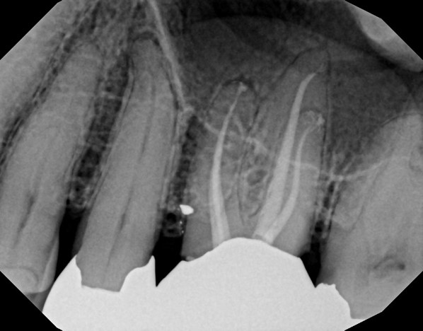 X-ray 3